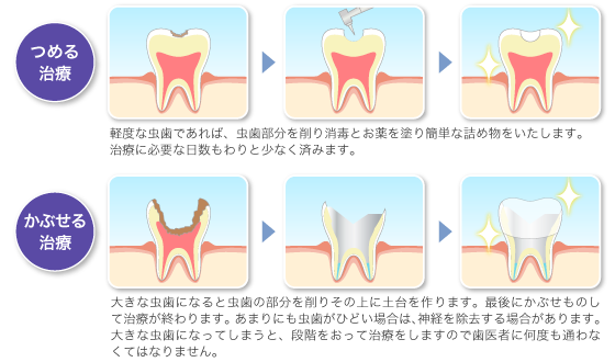 診療内容 | 武蔵村山市東大和市 の歯医者『MM歯科』