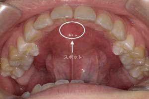 歯医者 舌 の 位置